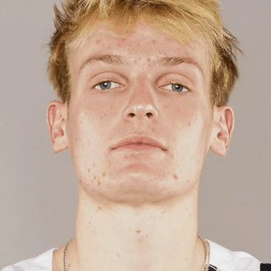 Andrew BALL